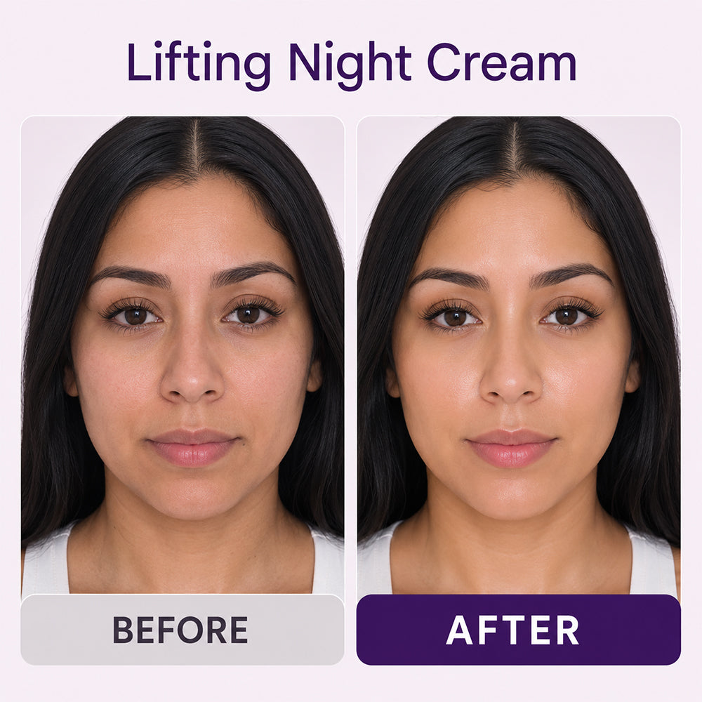 3D Lifting Cream skincare concerns