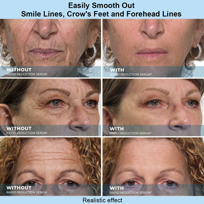 Purelums™ Instant Face Temporary Tightener – Instant visible results in 30 seconds