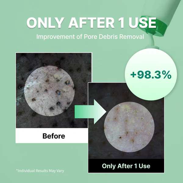 Centella Deep Pore Cleansing Foam