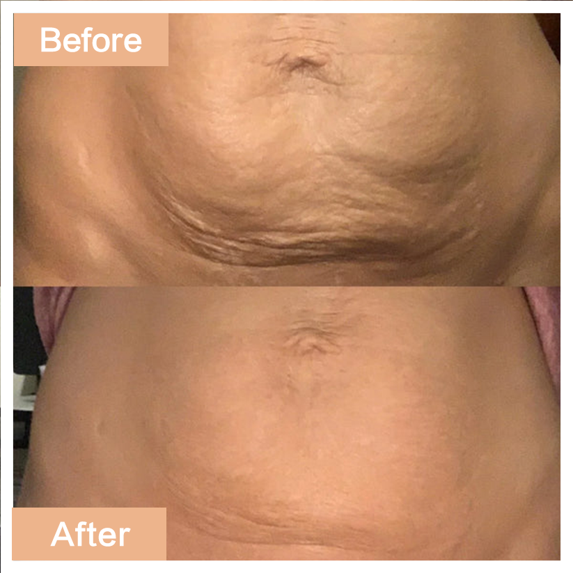 Age-Defying Revival Collagen & Stem Cell Body Oil