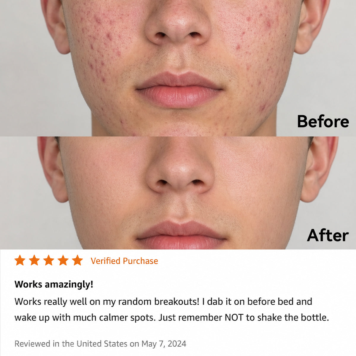 Korean 3H Overnight Drying Lotion- Targeted Spot Care for Troubled & Oily-Prone Skin