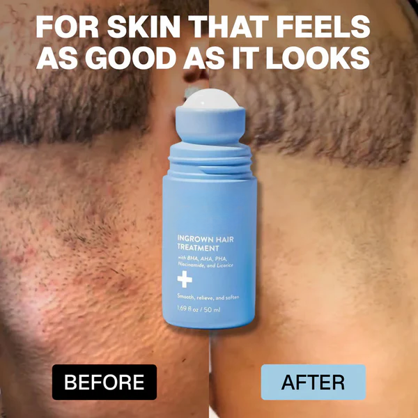 Purelums: Smoothing Solution For Ingrown Hairs
