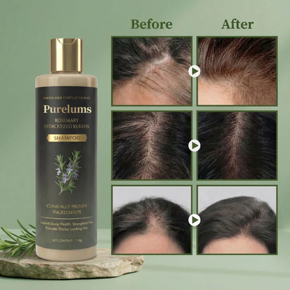 Purelums™ Growth-Support Shampoo - 2-Pack