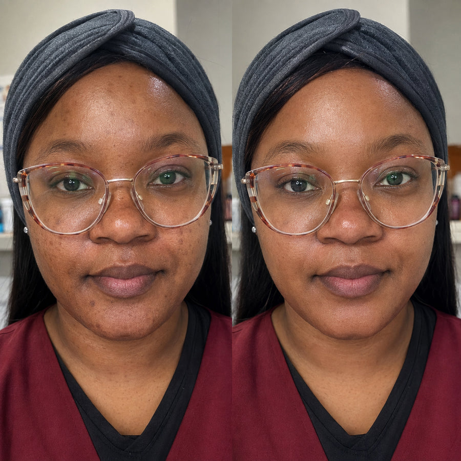 Customer skincare result