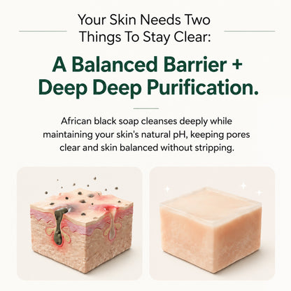 Pure Nilotica Shea Butter by Purelums™