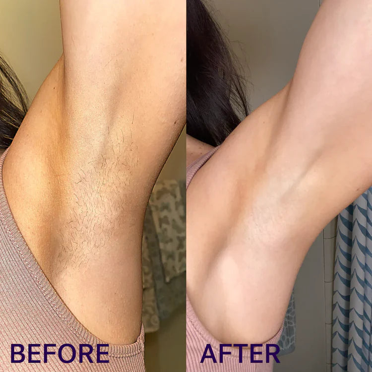 Before and after Purelums results