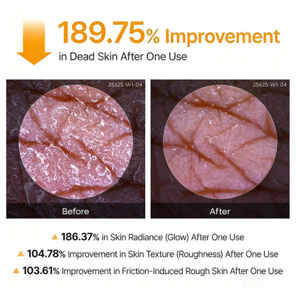 Purelums Peel Shot - Kojic + Turmeric Body Peel Spray
