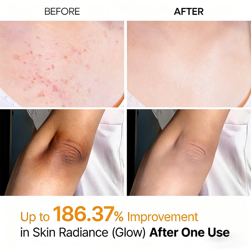 Purelums Peel Shot - Kojic + Turmeric Body Peel Spray