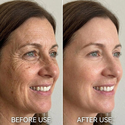 purelums Face Serum