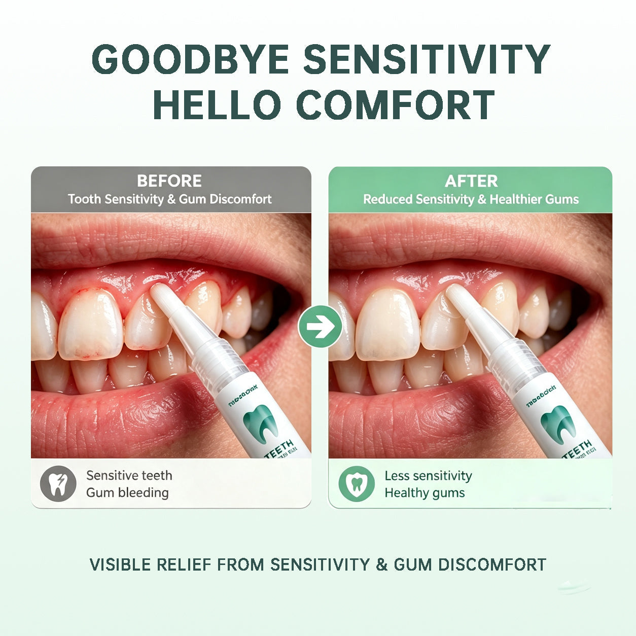 Teeth Repair Pen
