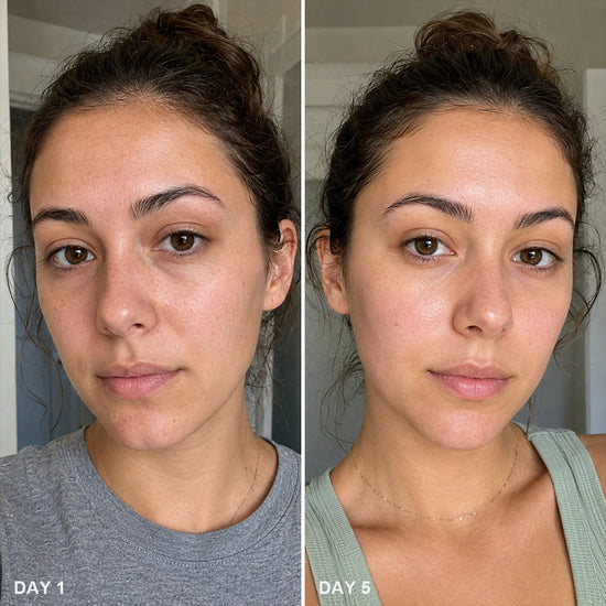 Before and After