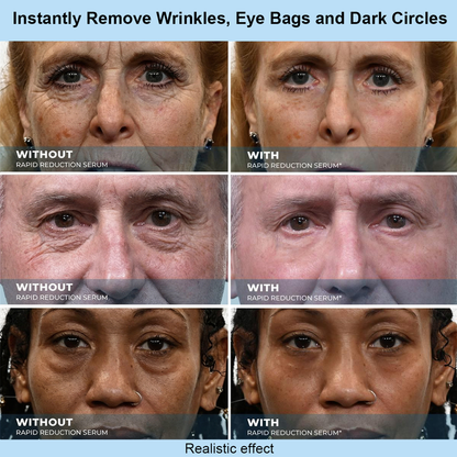 Purelums™ Instant Face Temporary Tightener – Instant visible results in 30 seconds