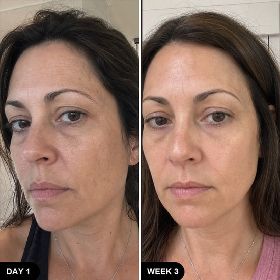 Before and After
