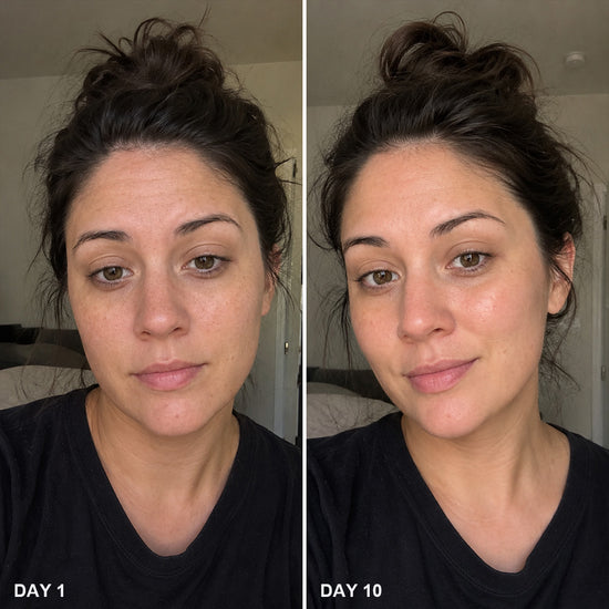 Before and After