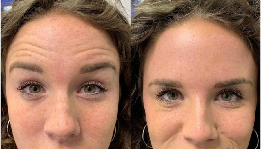 Customer skincare result