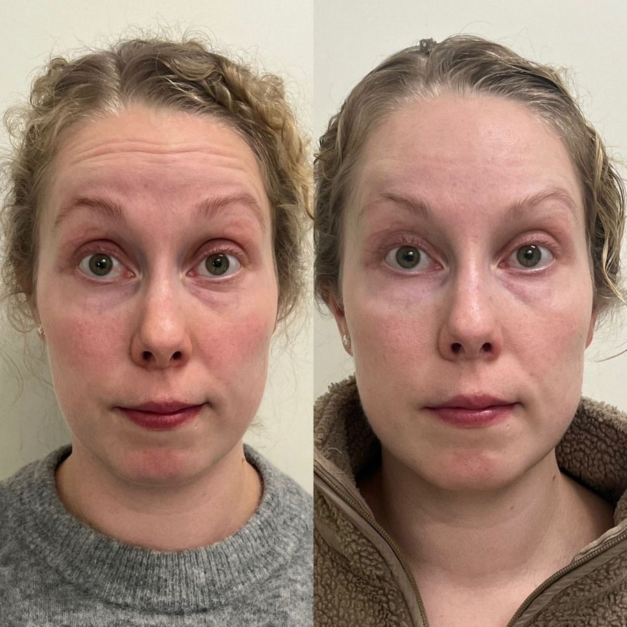 Customer skincare result