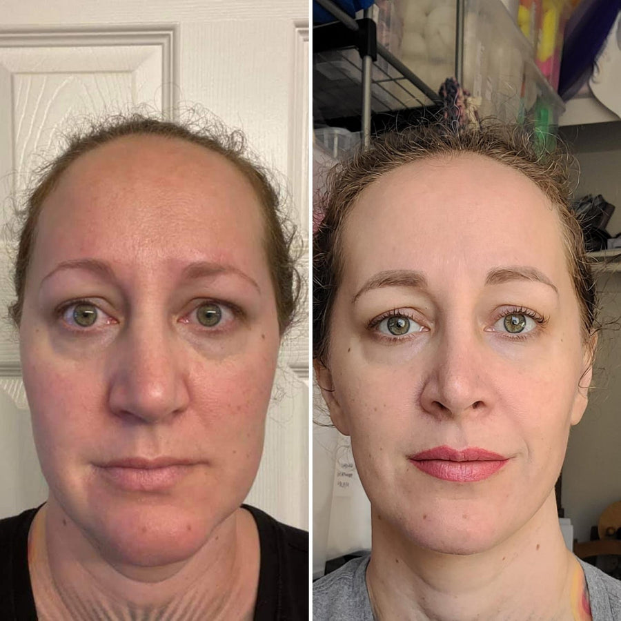 Customer skincare result